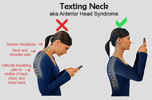 Text Neck Syndrome: Cause, Symptom & Treatment