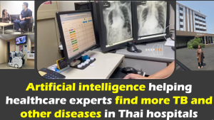 Artificial intelligence is helping healthcare experts find more TB and other diseases in Thai hospitals